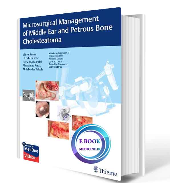 دانلود کتاب Microsurgical Management of Middle Ear and Petrous Bone Cholesteatoma2019(ORIGINAL PDF)